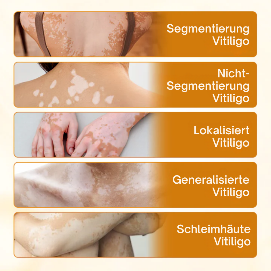 Fivfivgo® VitiCalm Bienengift-Creme，✔️95% Sichtbare Verbesserung In 4 Wochen ，Fördert Pigmentierung & Stellt Natürlichen Hautton Wieder Her
