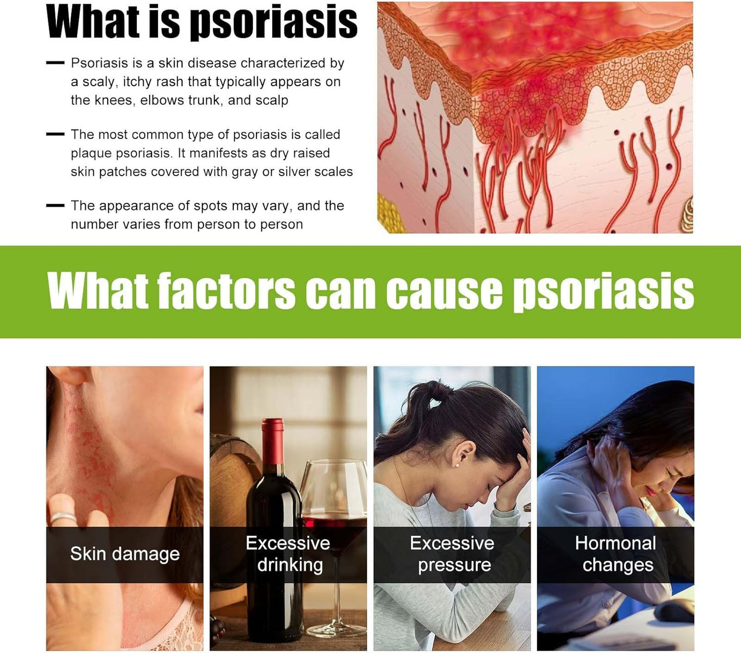 Todahof Bienengift-Psoriasis-Behandlungscreme, Todahof Bienengift-Psoriasis-Behandlungscreme, Todahof Bienengift-Creme, Psoriasis-Creme, Bienengift-Psoriasis-Behandlungscreme (3 Stück)