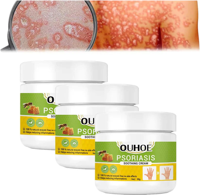 Todahof Bienengift Psoriasis Behandlungscreme, Todahof Bienengift Psoriasis Behandlungscreme, Todahof Bienengift Creme, Psoriasis Creme, Bienengift Psoriasis Behandlungscreme (3 Stück)