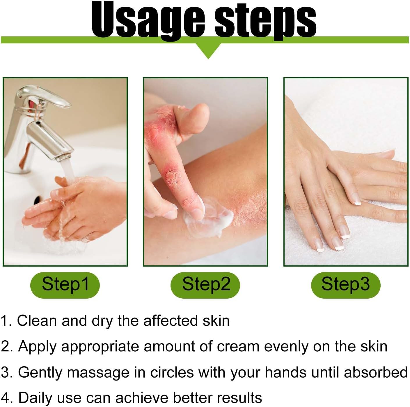 Todahof Bienengift-Psoriasis-Behandlungscreme, Todahof Bienengift-Psoriasis-Behandlungscreme, Todahof Bienengift-Creme, Psoriasis-Creme, Bienengift-Psoriasis-Behandlungscreme (3 Stück)