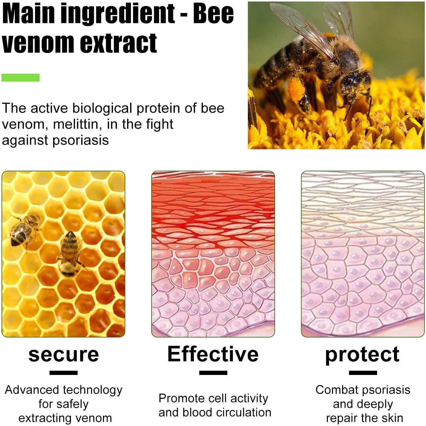 Todahof Bienengift-Psoriasis-Behandlungscreme, Todahof Bienengift-Psoriasis-Behandlungscreme, Todahof Bienengift-Creme, Psoriasis-Creme, Bienengift-Psoriasis-Behandlungscreme (3 Stück)