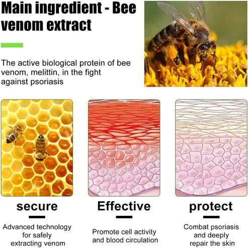 Todahof Bienengift Psoriasis Behandlungscreme, Todahof Bienengift Psoriasis Behandlungscreme, Todahof Bienengift Creme, Psoriasis Creme, Bienengift Psoriasis Behandlungscreme (3 Stück)