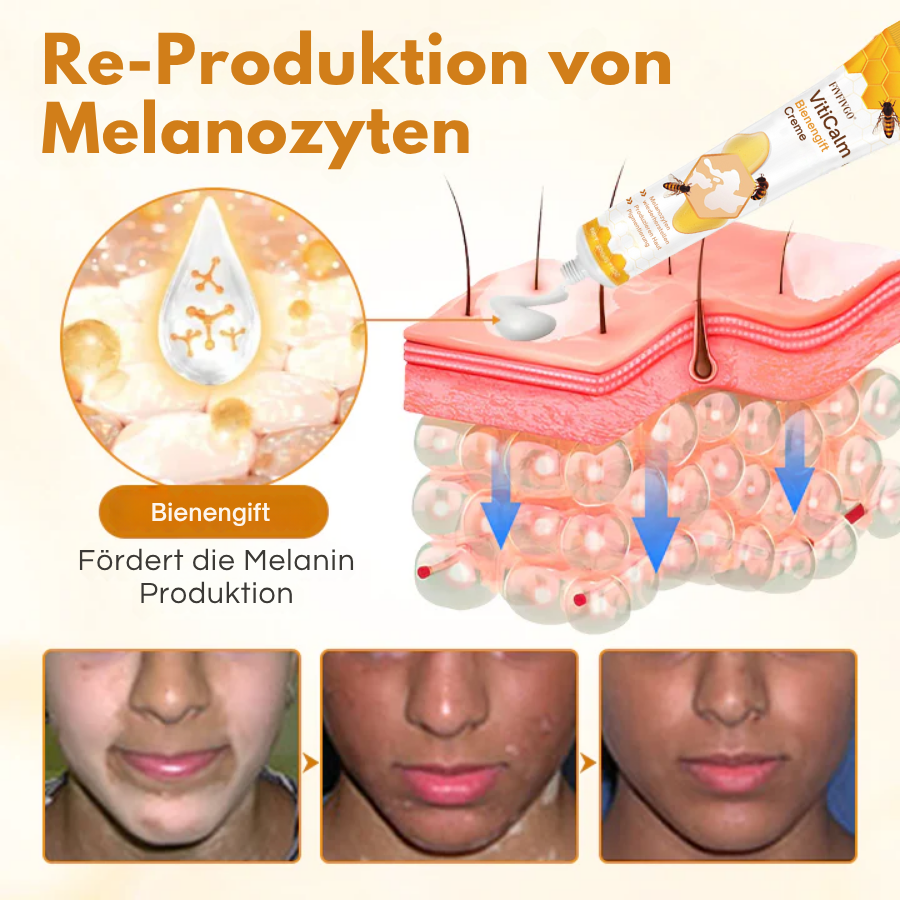 Fivfivgo® VitiCalm Bienengift-Creme，✔️95% Sichtbare Verbesserung In 4 Wochen ，Fördert Pigmentierung & Stellt Natürlichen Hautton Wieder Her