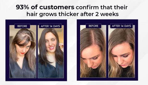 🌿AKTION ZUM LETZTEN TAG – 50 % RABATT🌿 HZA™ Natürliches Haarwuchsspray