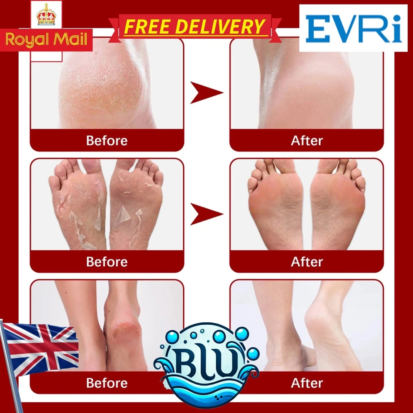 Natürliche Honig+VitE Fußpflege, Tötet Fußpilz ab, entfernt abgestorbene Hautzellen und macht die Füße so weich wie Babyfüße