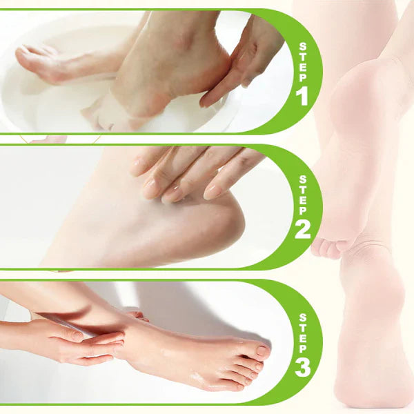 2025 Neue Stiftung Warentest getestet - Antimykotika und Fußpilz, feuchtigkeitsspendende und Anti-rissige Fußcreme, kann den Pilz an den Füßen effektiv abtöten und Fußpilz heilen